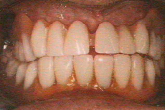 Before