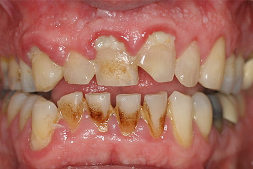 Before