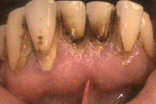 Before