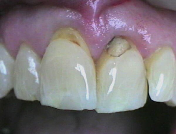 Before
