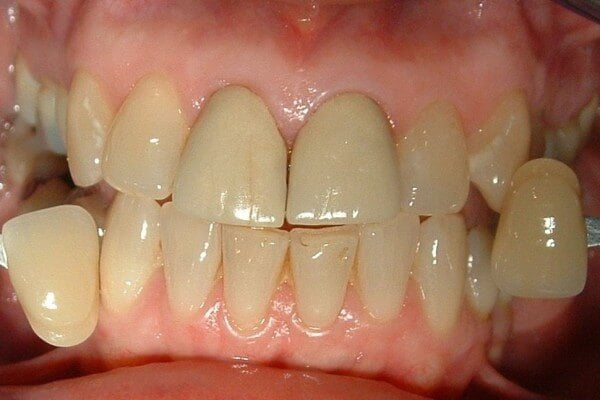 Before