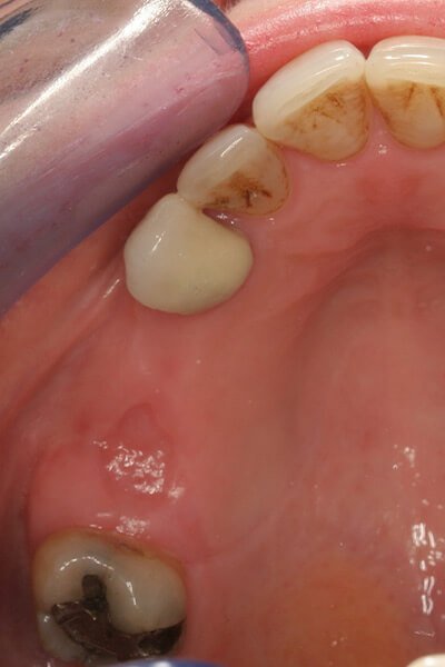 Before