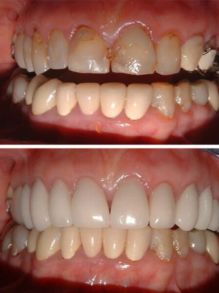 before-after