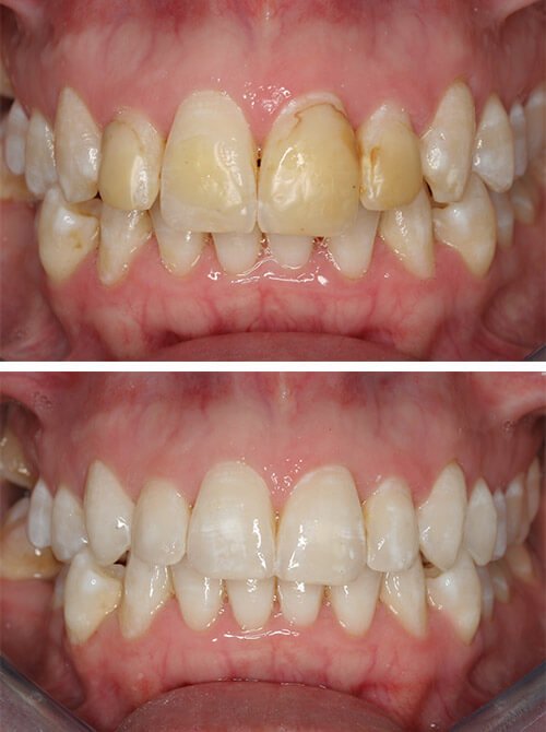 Dentist Sidcup Cosmetic Dentist Birkbeck Dentistry