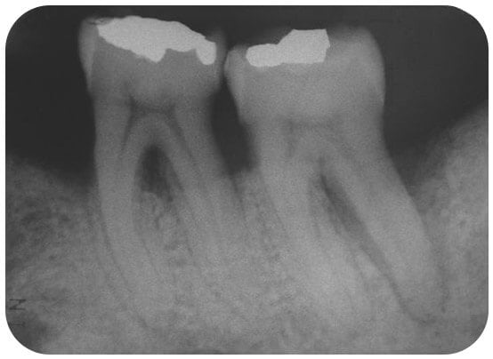 case1-before