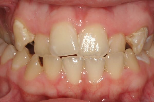 Before