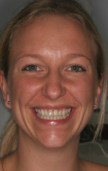 Full face final appearance