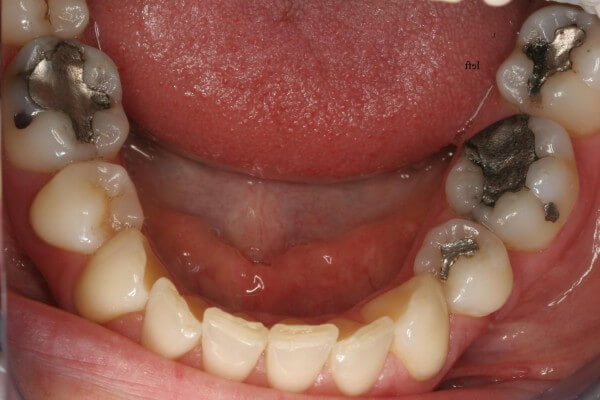 Before