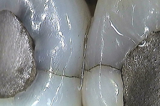 pic1-micro-cracks