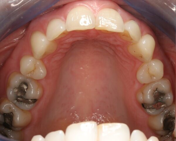 Before