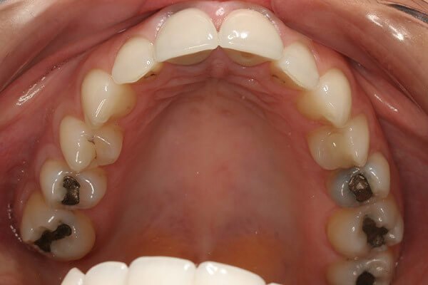 Before