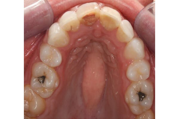 Final result after only 10 months