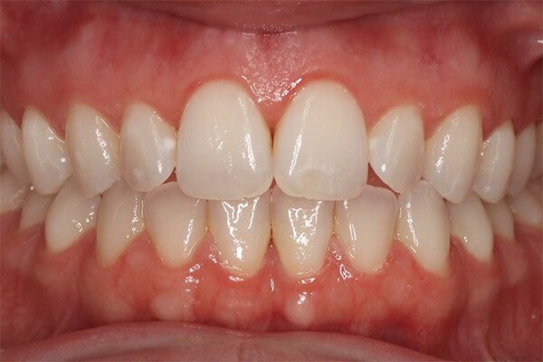 Pre-treatment situation